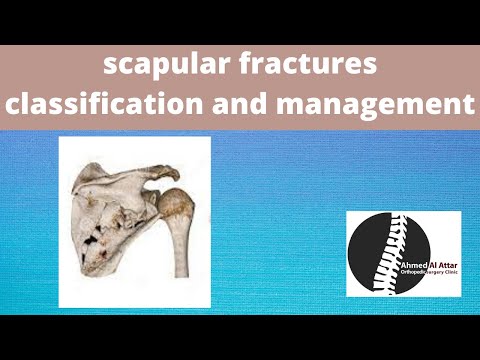 scapular fractures classification and management by dr el attar