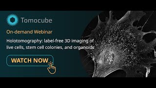 [Webinar] Holotomography: label-free 3D imaging of live cells, stem cell colonies, and organoids