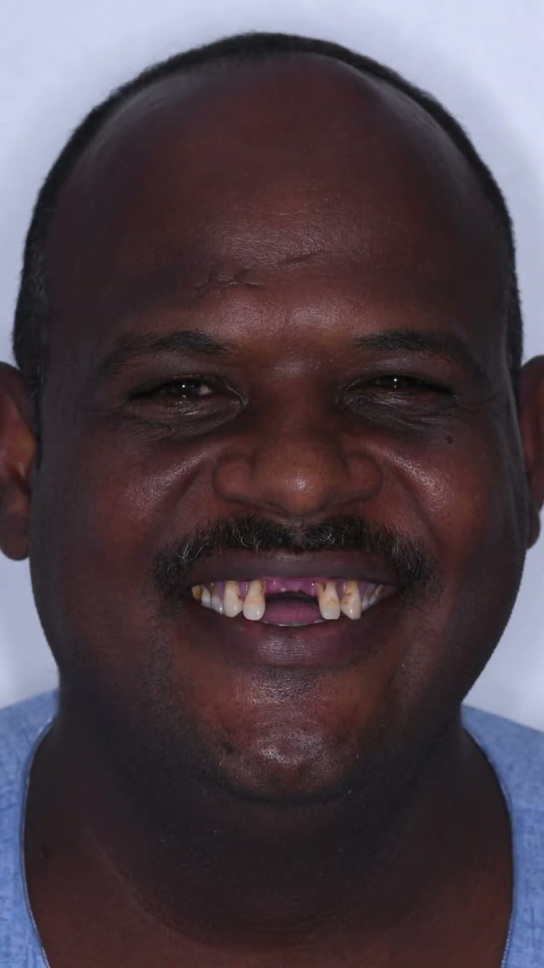 سودان – زراعة فكين