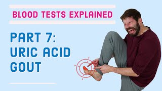 Gout, Uric Acid Blood Test - What does it mean?