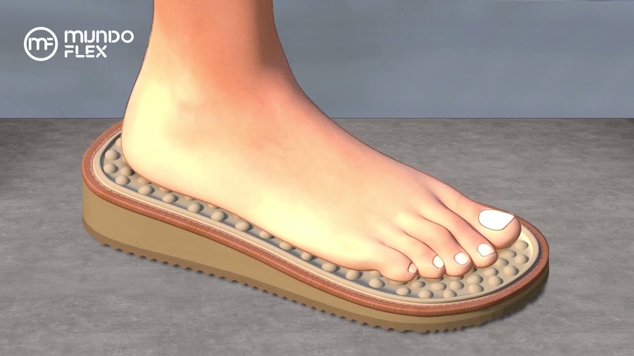 Watch Now Calçados Mundoflex para Esporão e Fascite Plantar Calçados Mundoflex para Esporão e Fascite Plantar