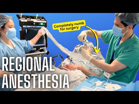 Regional Anesthesia: Numbing the Pain, Not the Patient | Vibepedia