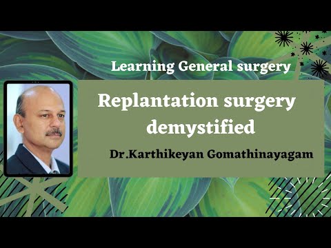 Replantation surgery   demystified   Dr Karthikeyan Gomathinayagam MS MCh