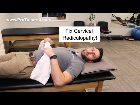 How to Fix Cervical Radiculopathy at Home!