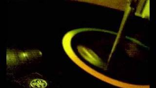 Peter & Gordon: Here Comes The Hurt again