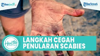 Langkah Tepat Mencegah Penularan Kutu Scabies yang Picu Rasa Gatal, Termasuk Menjaga Kebersihan