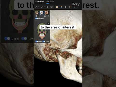 SMARTDent : 5D Tutorial #2-7. Slice Explorer