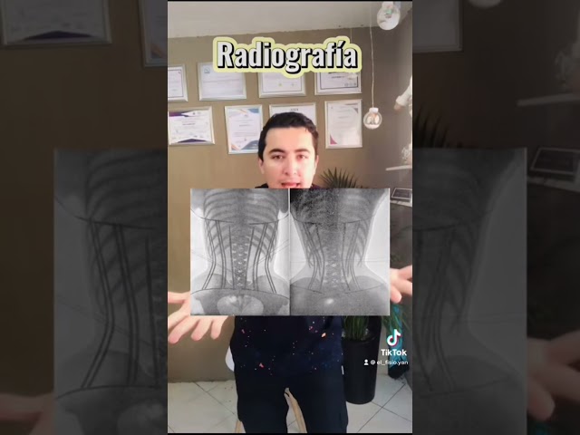 Vídeo relacionado con KUMAYES Fajas Reductoras Mujer Moldeadora Waist Trainer Corset Reductor Cinturón Abdomen Segmentada Faja Colombiana Corsé Bustier Shapewear Postparto (Negro, Small)