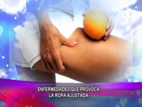 Enfermedades que provoca la ropa ajustada