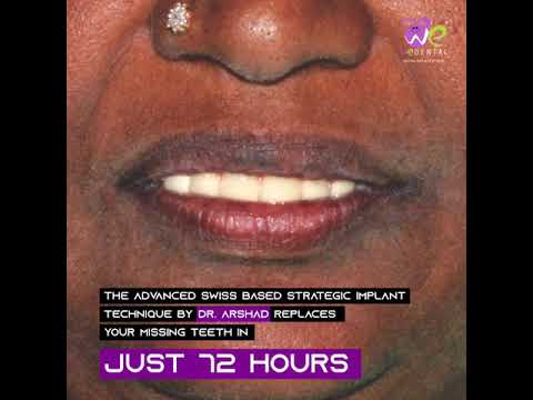  patient undergoes Strategic Implant service in coimbatore