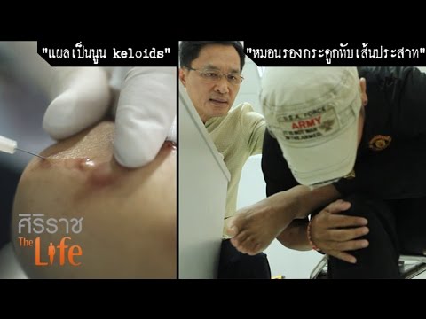 เพิ่มปริมาณการหน้าอก เพิ่มขนาดเต้านม 3-4