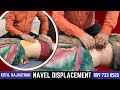 Navel Displacement Constipation Gas And Acidity Abdominal Pain And Swelling Get Fastest Relief
