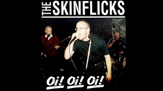 Download lagu SKINFLICKS - Oi! Oi! Oi! (Singles 2001-2022) mp3
