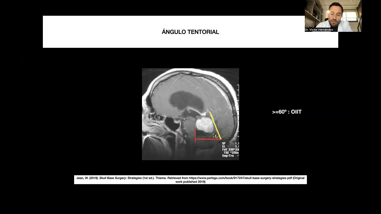 Victor Hernandez Alvarez-14