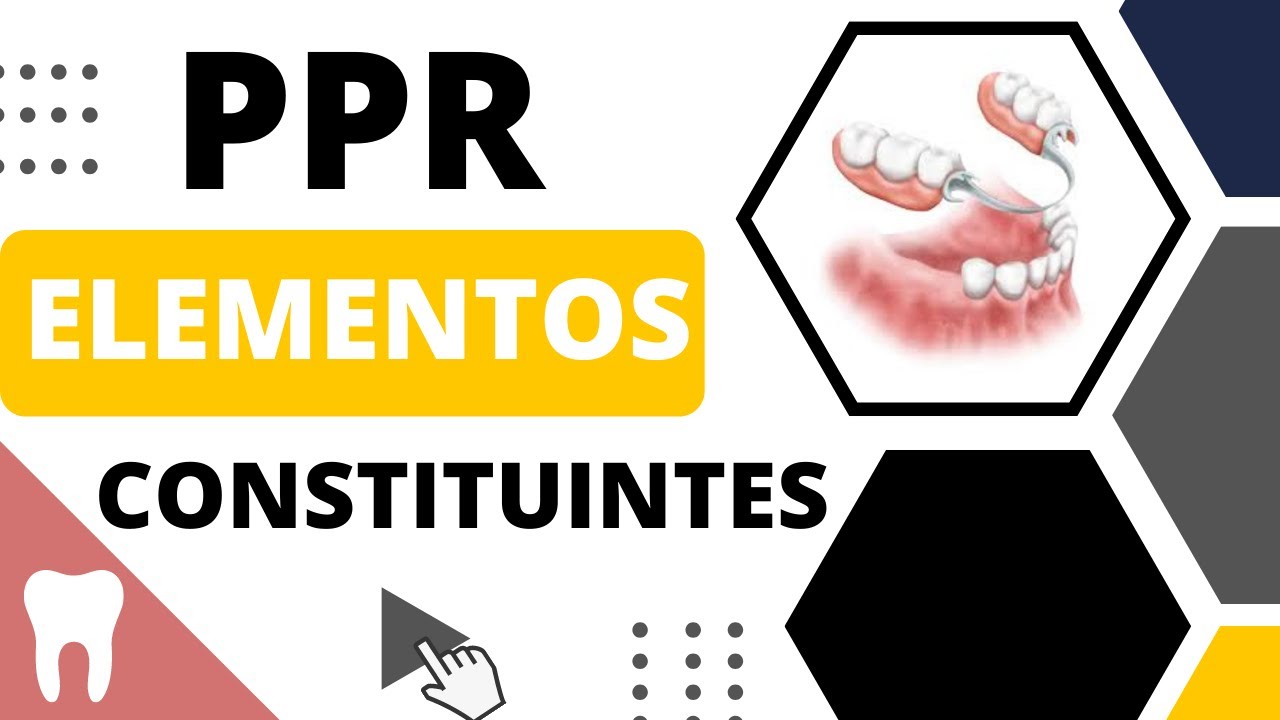 PRÓTESE PARCIAL REMOVÍVEL | ELEMENTOS CONSTITUINTES