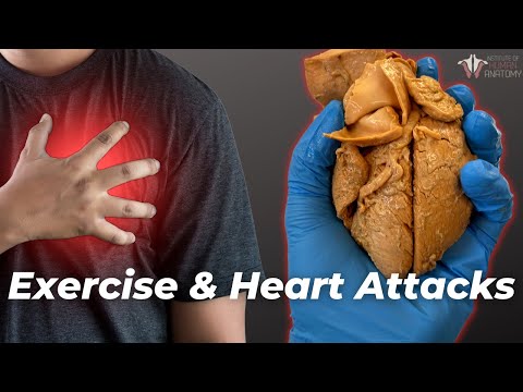 Heart Attack Prevention: The Best Strategies for Safety