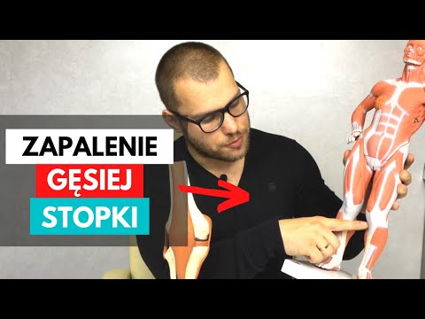 Blokada kciuka koślawego pro.otzyvy Guzek pod skórą na stopie