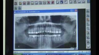 Dentistas en Madrid, Clinica Dental Vistalegre - Clinica Dental Vistalegre