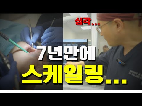 7년 만에 치과 방문 후기