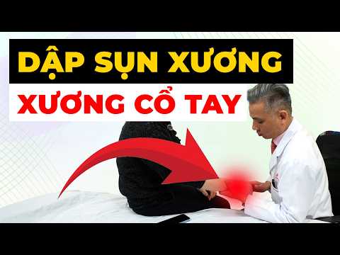 Dập sụn xương cổ tay do chấn thương: Vì sao vẫn đau dai dẳng? Đừng bỏ qua!