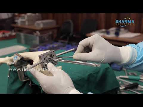 Hinged Total Knee Replacement