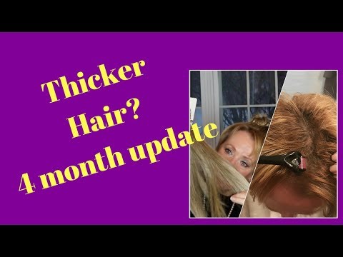 Hair Loss 4 month update | Derma Rolling Hair | Hair Care After Sixty | Nutri-Ox | MatureBeauty