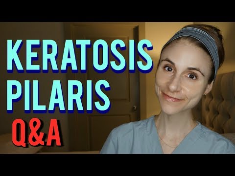 KERATOSIS PILARIS: Q&A WITH A  DERMATOLOGIST| Dr Dray