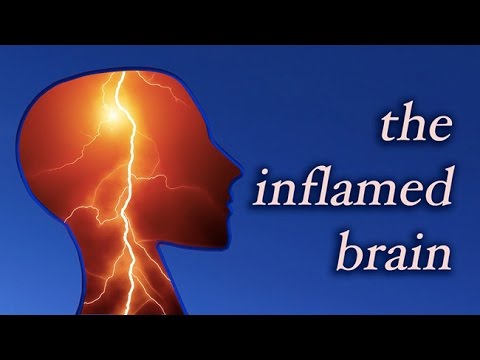 The Inflamed Brain - YouTube