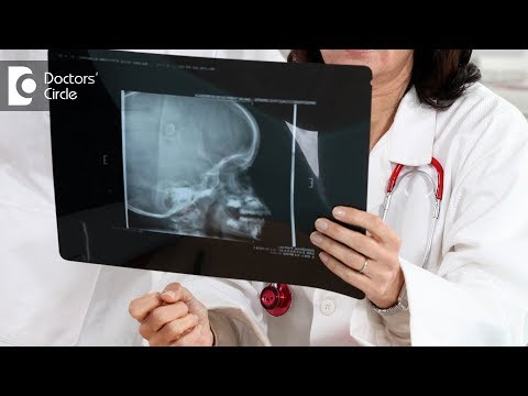 Is a Malignant Tumour totally removable? - Dr. Bopanna K M