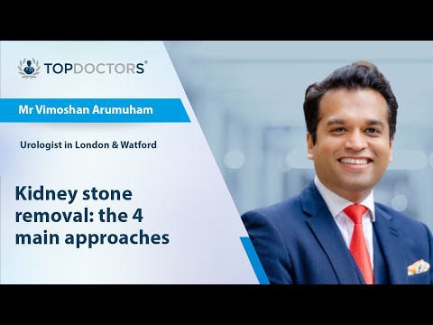 Kidney stone removal: the 4 main approaches - Online interview