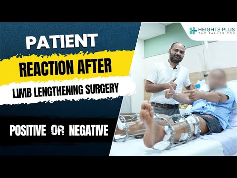 Patient Reaction After Limb Lengthening (Height Increasing Surgery)