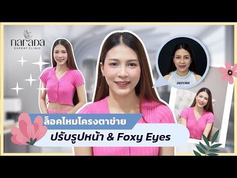 ร้อยไหม หน้าเรียว