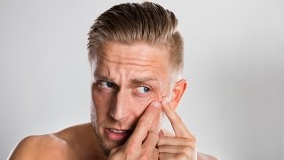 Ai trecut de adolescenta si inca te supara cosurile? Atunci urmareste acest episod!