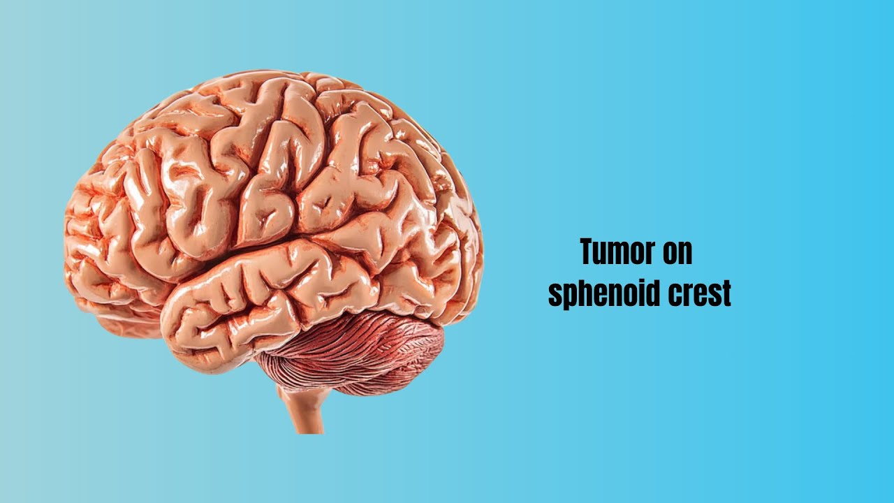 David Tafur Muñoz-2488