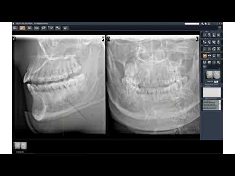 Morita i Dixel SCOUT 2D manejo desde el PC