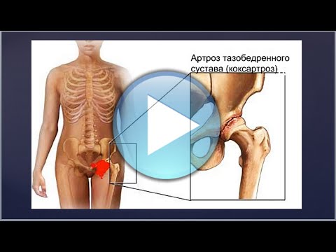 Sacroiliac ízületek