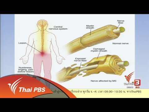 Maynkraft ทีมค้อนของ ธ อร์ กระตุ้นต่อจิตและประสาท