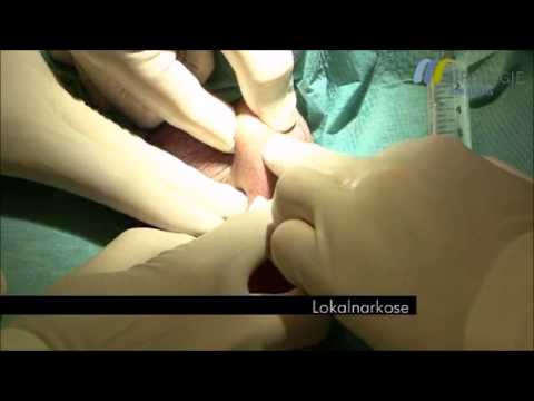 Preis Prostamol uno in Ukraine Prostata Hoden kalt