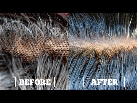 Come togliere posti di pigmentary su mani di fotografia Perché rosso in lentiggini