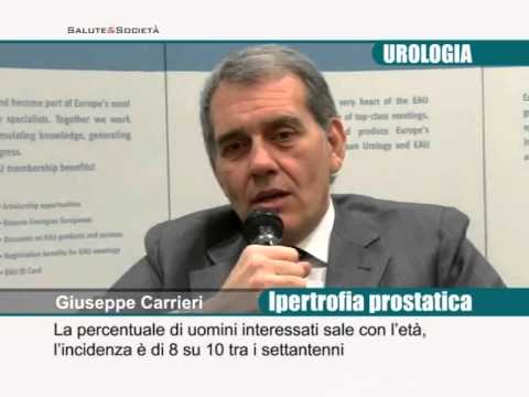 Flussi liquido prostatico Malattie della prostata di uomini