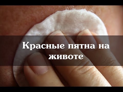 Ахромин крем отбеливающий отзывы состав Как избавится от веснушек народной медициной