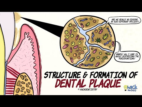 Dental Plaque: Structure and Formation