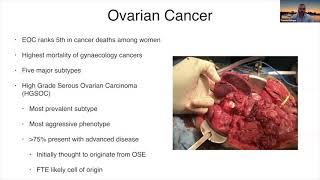 Stanford Radiology: CEDSS (Winter) 2021, Kislinger: Fluid-based biomarkers-ovarian &amp; prostate cancer