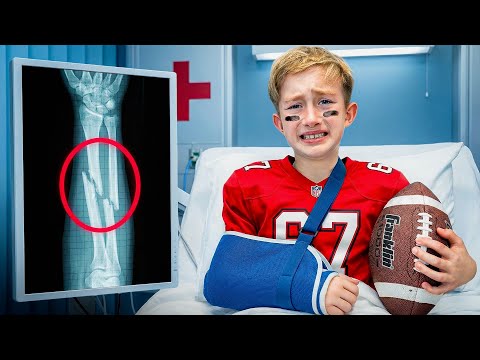 Levi Broke His Arm..