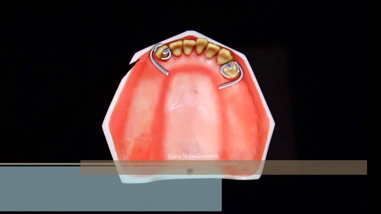 Planejamento Classe I de Kennedy