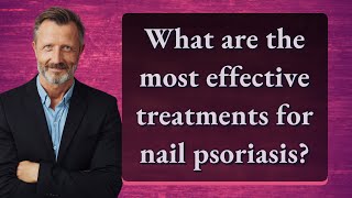 What are the most effective treatments for nail psoriasis?