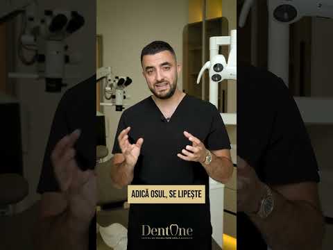 Cat dureaza integrarea (vindecarea) unui implant dentar?