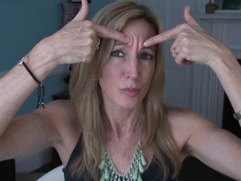 My Experience With Botox for Forehead Wrinkles Video