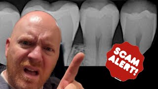 Deep cleaning dental scam?!