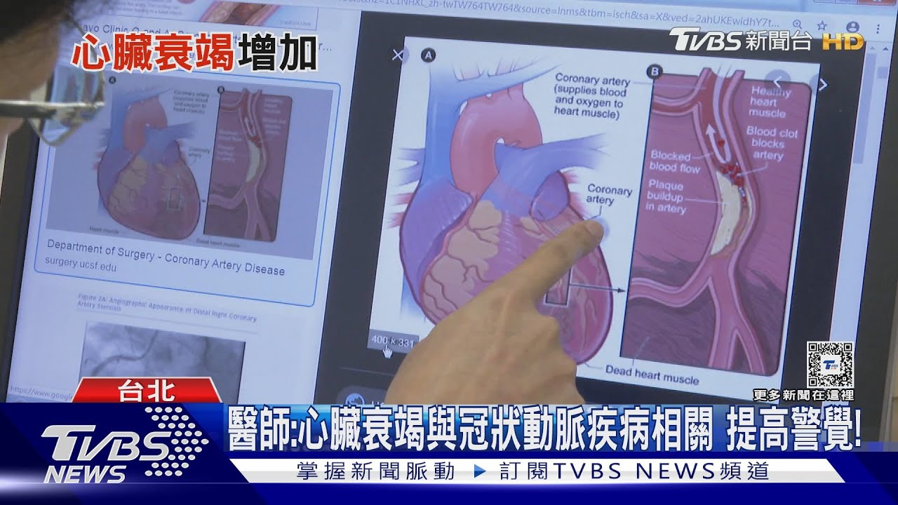 注意!突然冒出「這要命症狀」 心臟衰竭惡化 死亡率比癌症高
